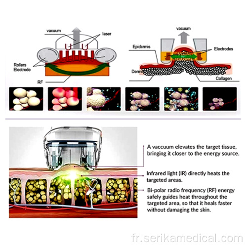 Vacuum RF Cavitation laser Machine minceur